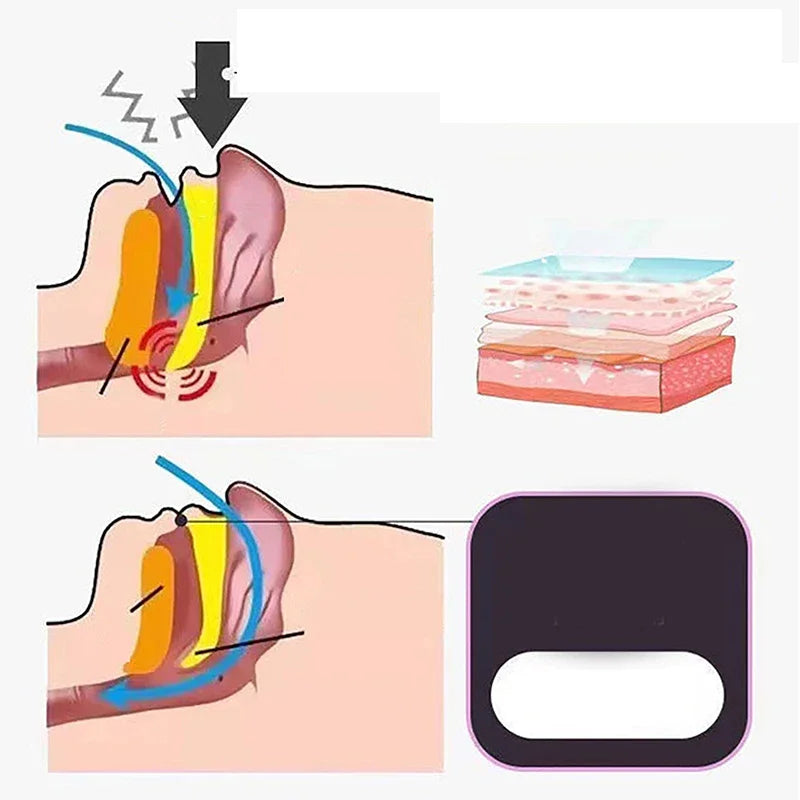 30Pcs Anti-Snoring Mouth Seal Strips – Sleep Aid for Better Breathing