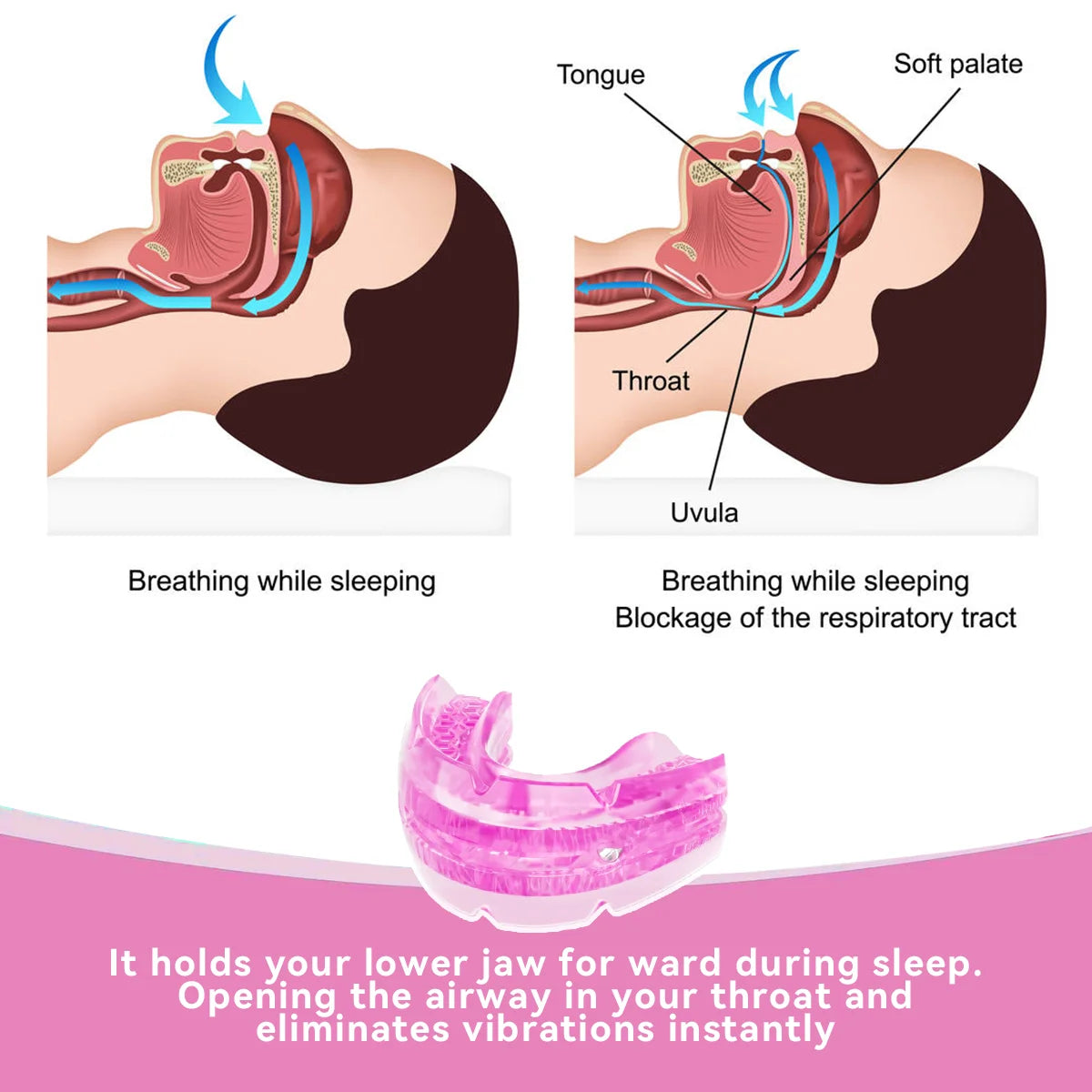 Anti-Snoring & Bruxism Mouth Guard