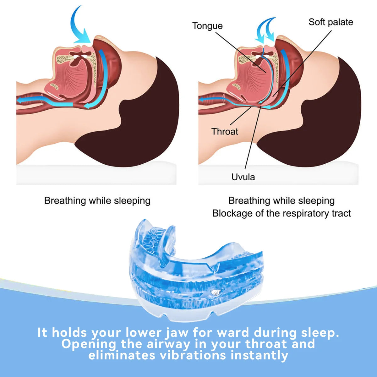 Anti-Snoring & Bruxism Mouth Guard