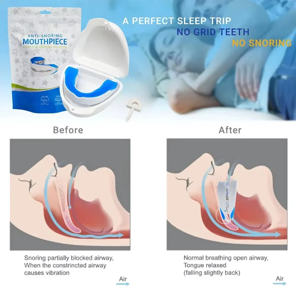 Silicone Anti-Snoring Mouth Guard